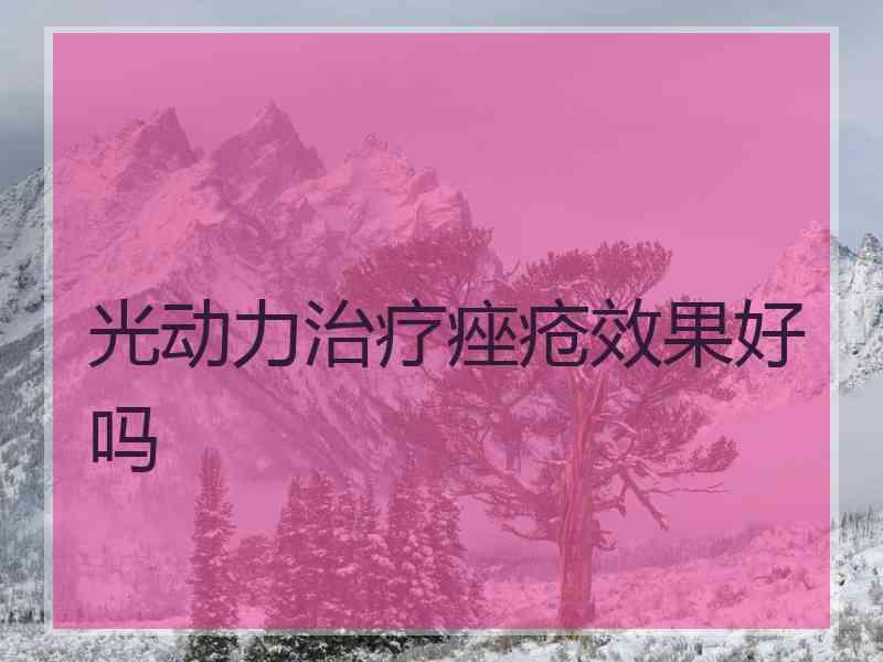 光动力治疗痤疮效果好吗